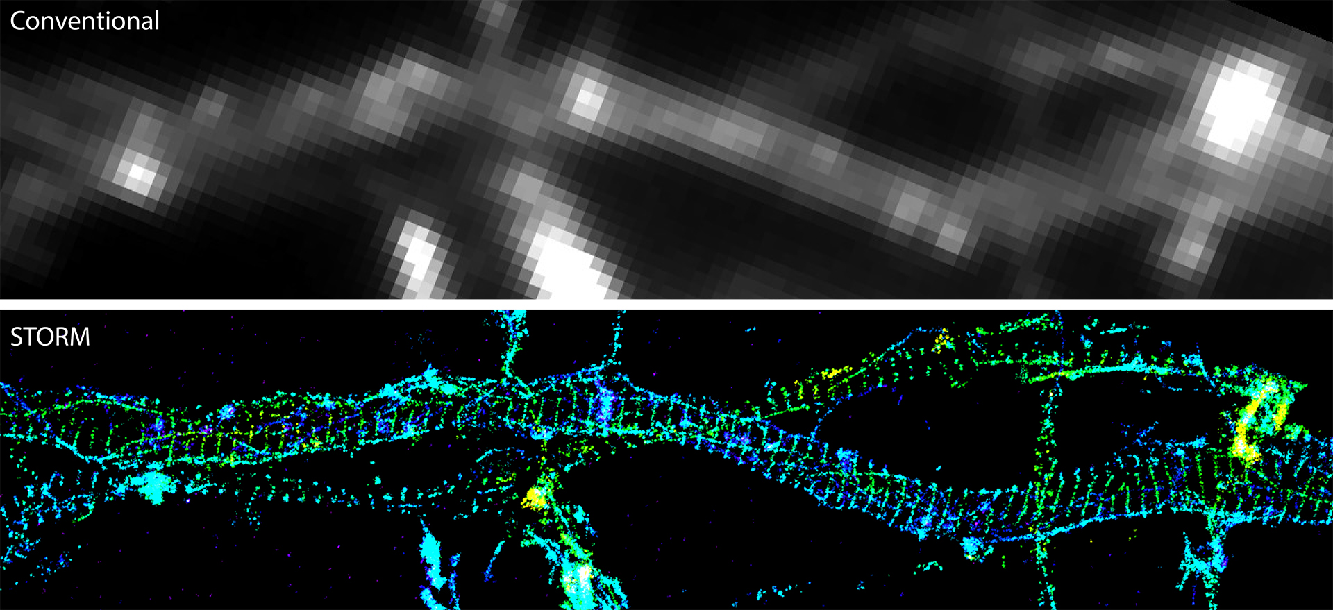 Comparison of conventional and 3D stochastic optical reconstruction microscopy (STORM) images of actin in the axons of neurons
