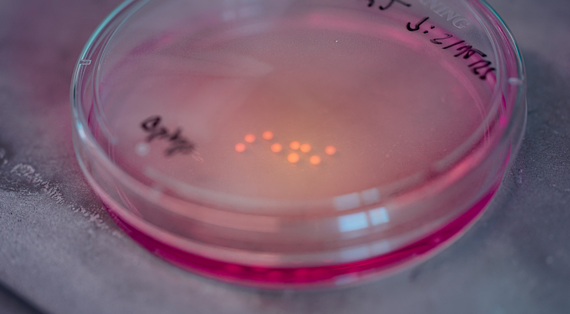 A close-up view of a lab dish containing human brain organoids