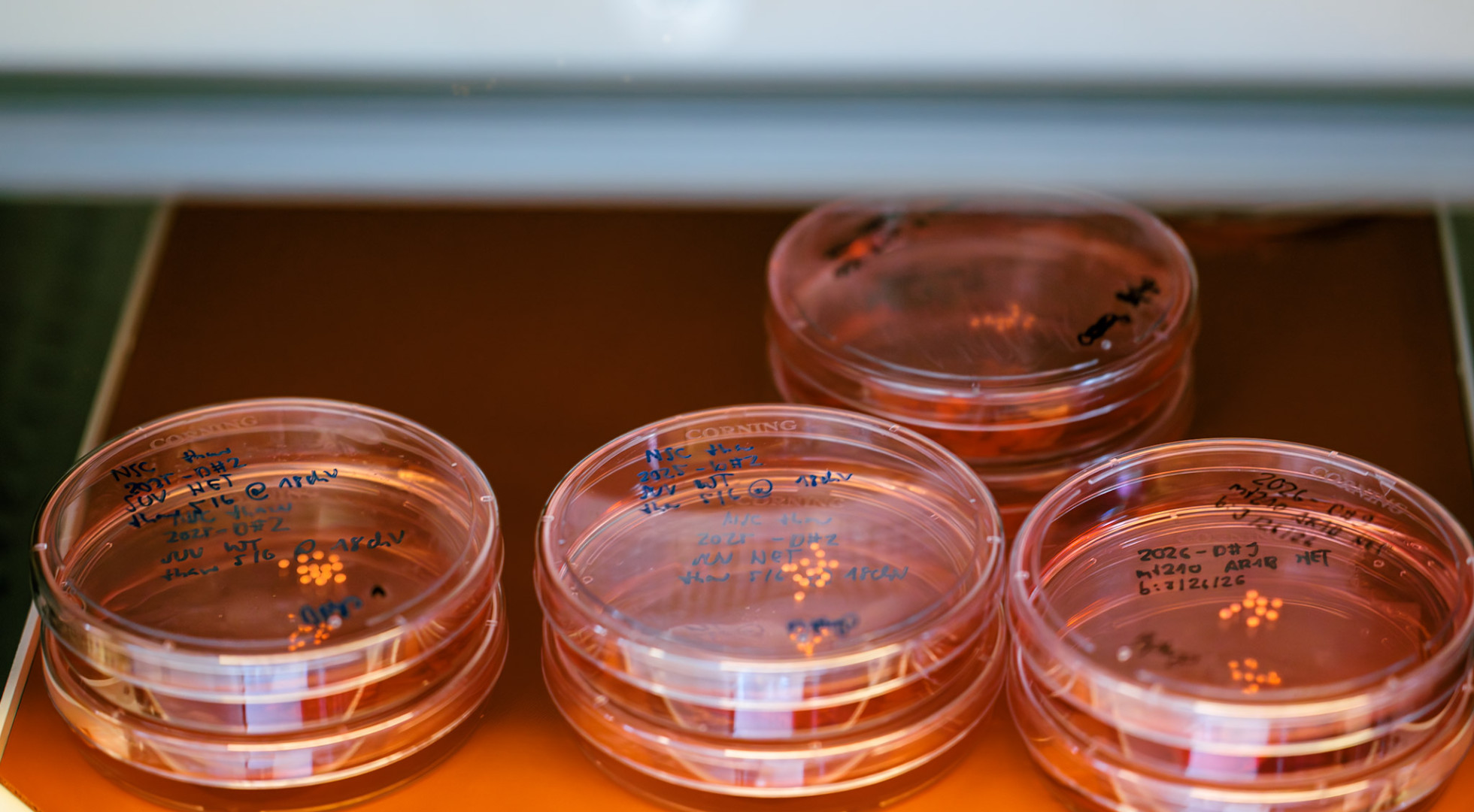 A stack of lab dishes containing lab-grown human brain organoids
