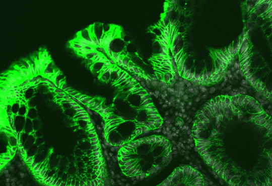 A fluorescence micrograph of mouse colon shows dysfunctional and abnormal cells in green against a black background