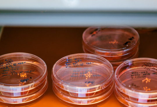 A stack of lab dishes containing lab-grown human brain organoids