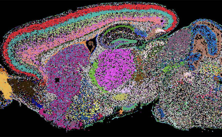 Cell atlas of a whole mouse brain