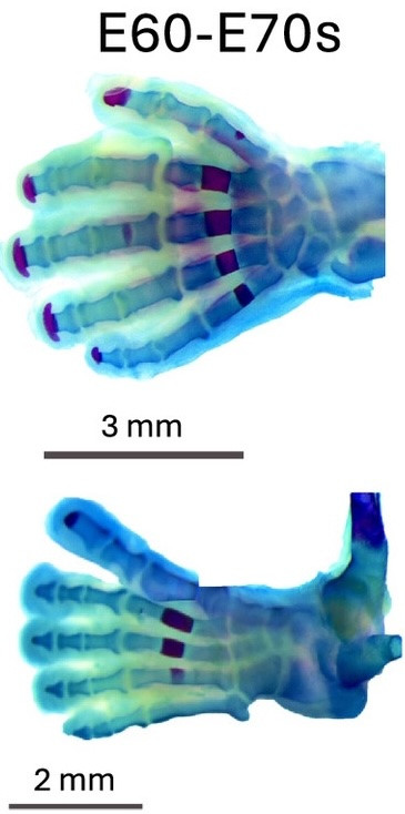 Images of human hand and foot skeletons at day 67 of gestation
